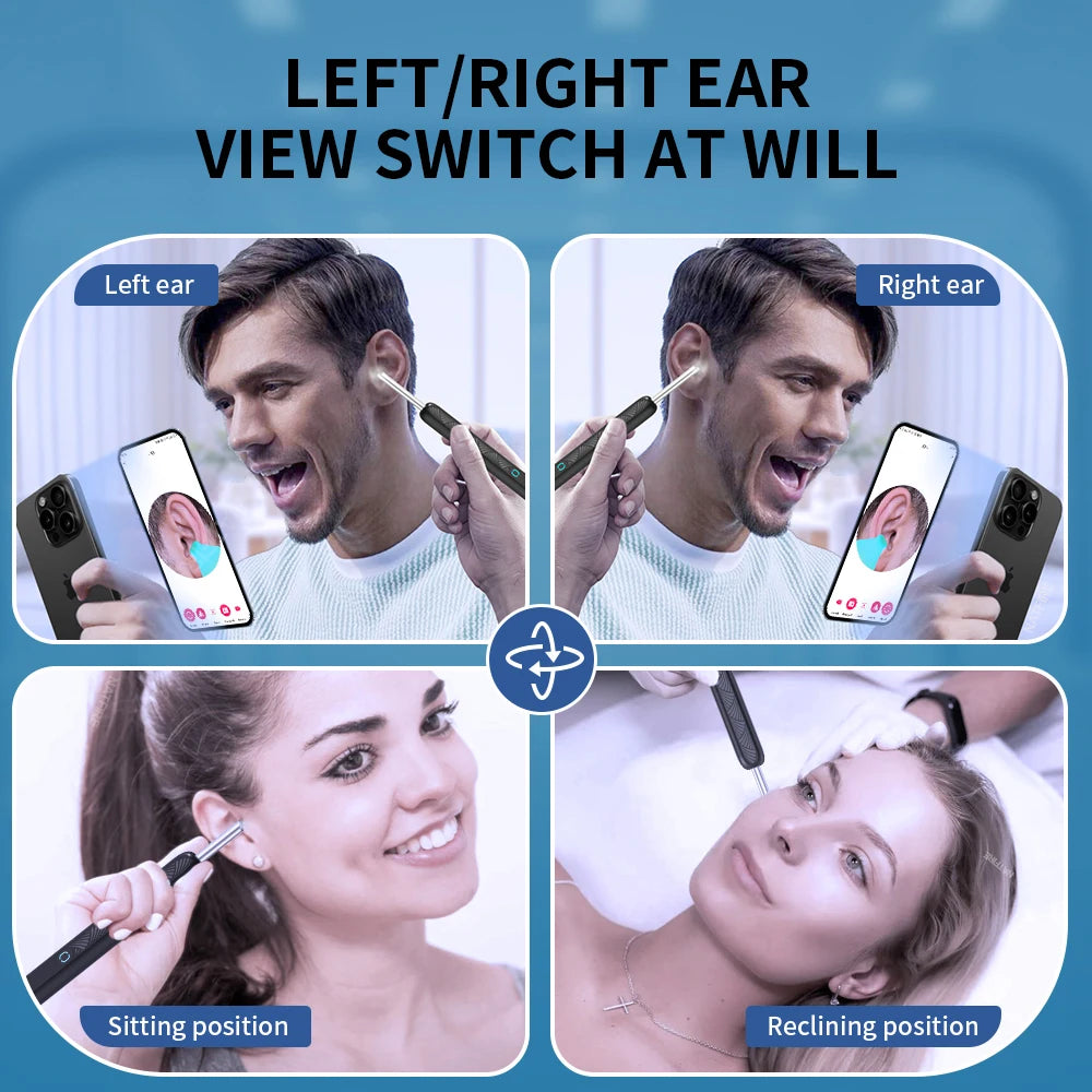 Waxify Pro — Wireless Ear Wax Removal Tool With Camera